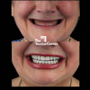 Slider image (8) The Dental Corner